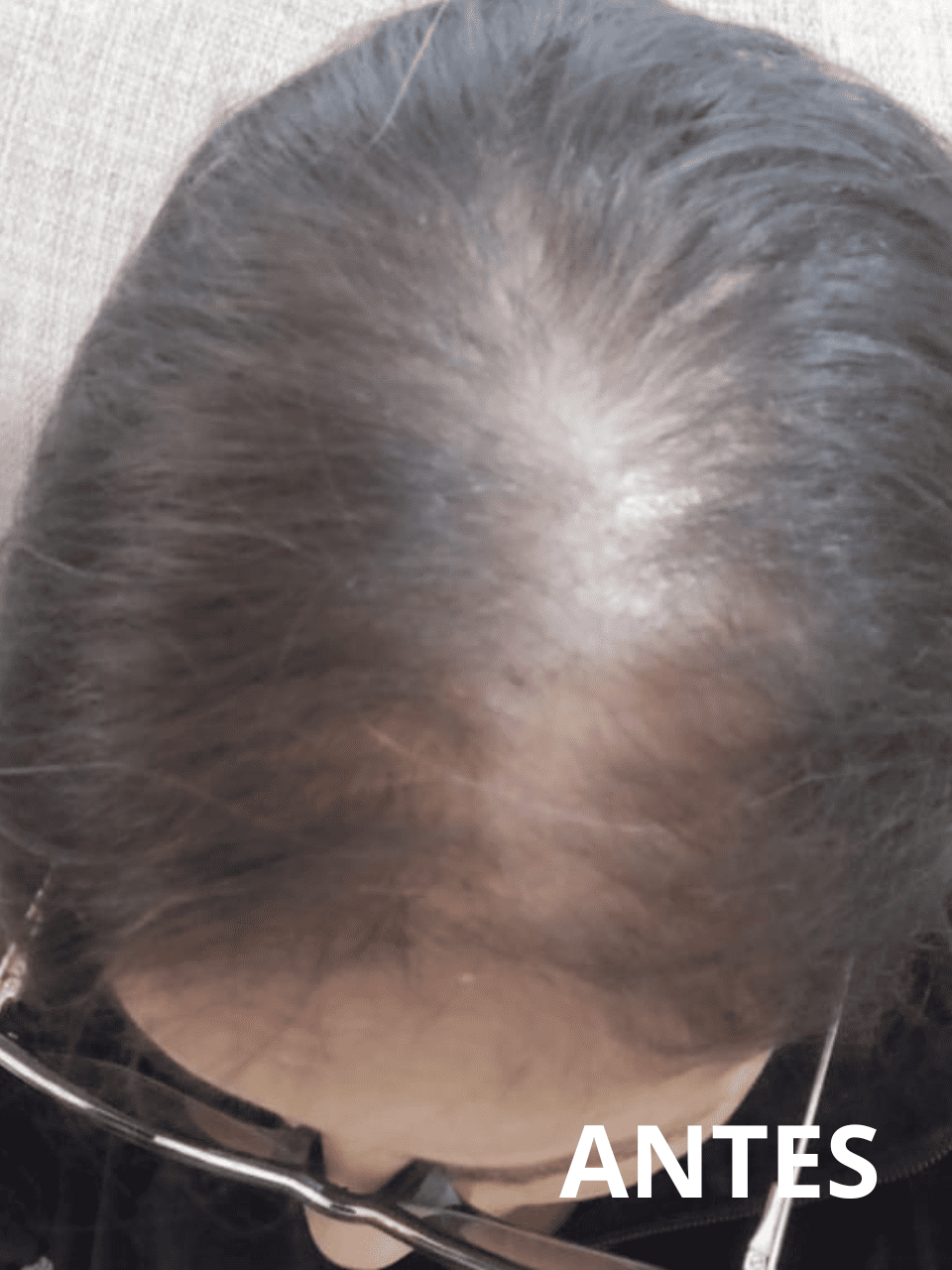 Resultado1_folipower