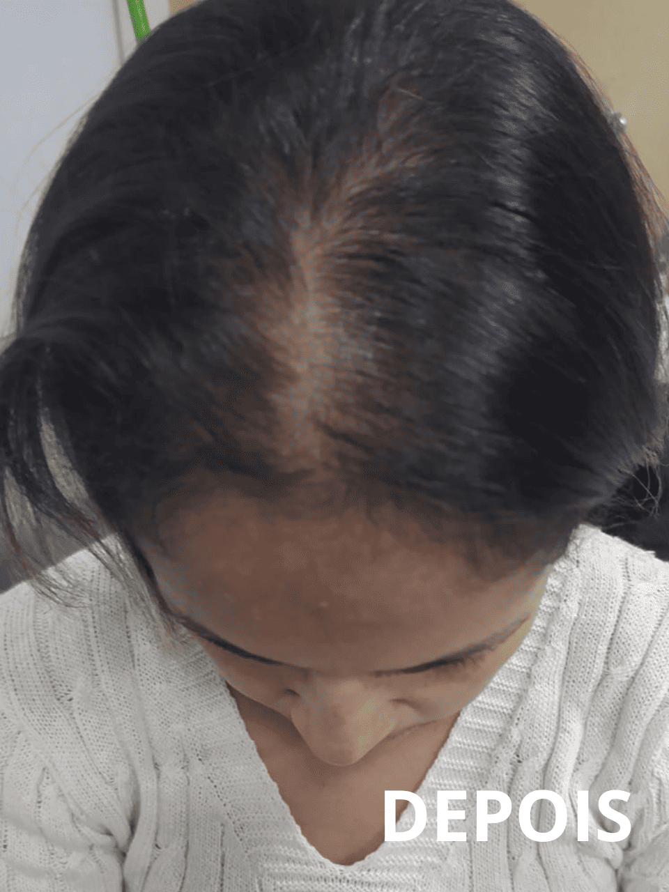 Resultado3_folipower