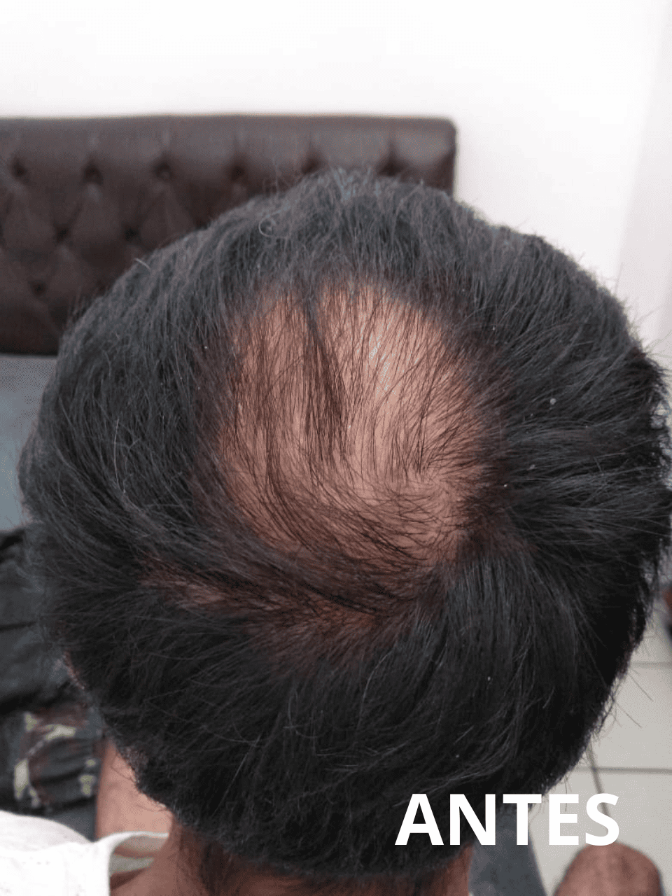 Resultado4_folipower