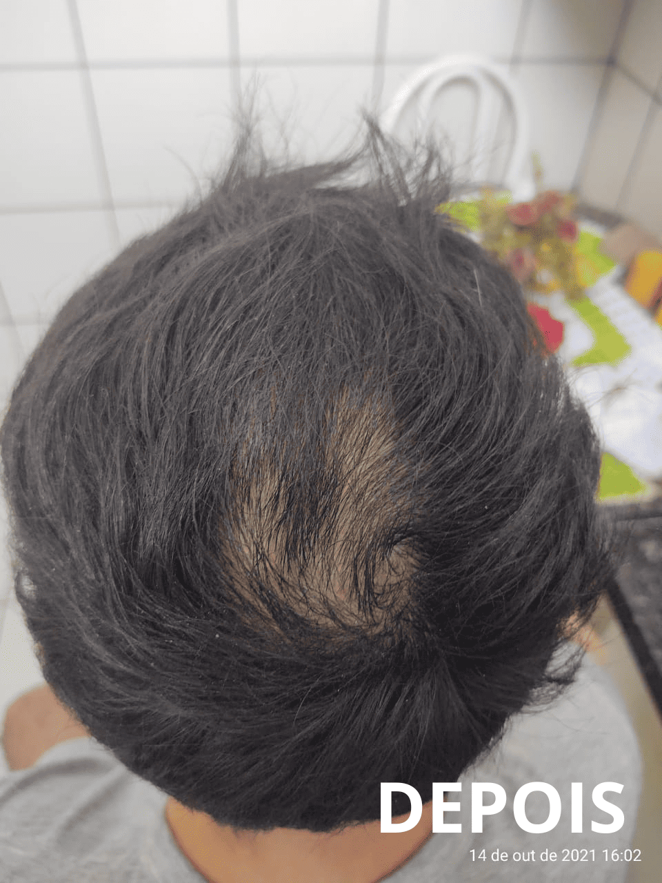 Resultado5_folipower