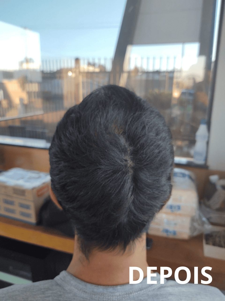 Resultado6_folipower