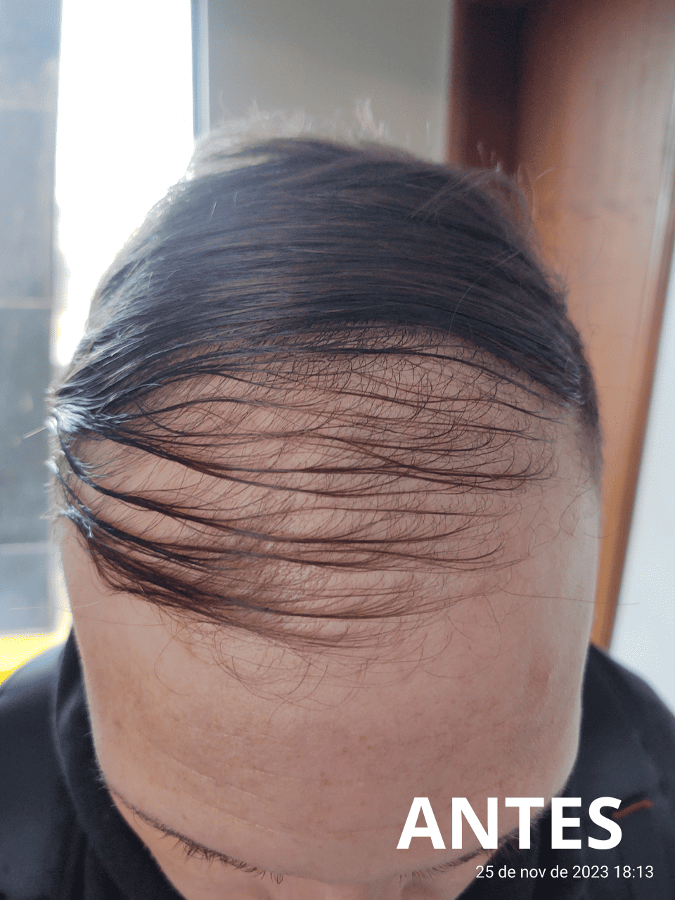 Resultado7_folipower