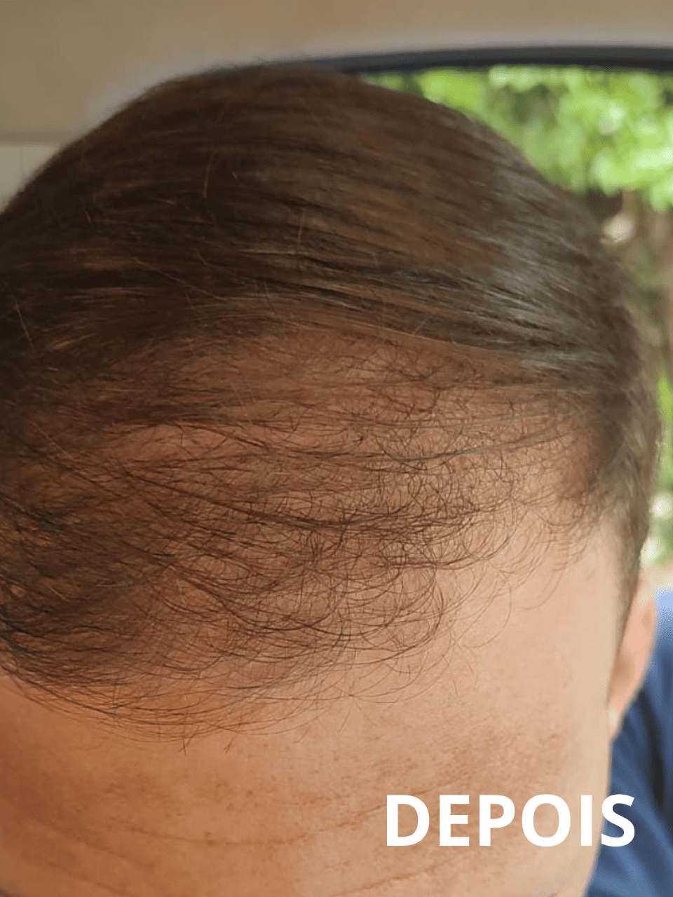 Resultado8_folipower